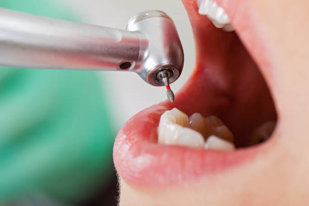 Best Emergency Cosmetic Dentistry in Huntertown, IN